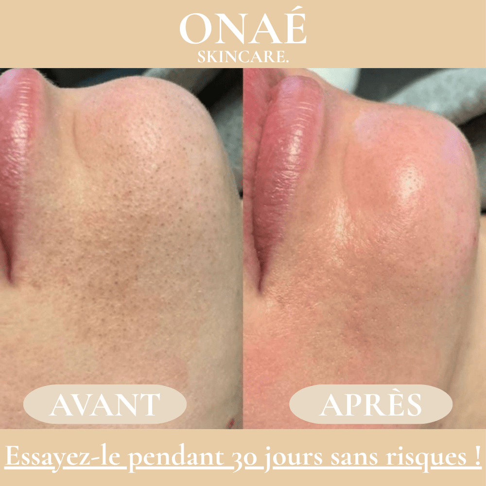 ONAÉ - Exfoliant Doux au Riz Blanc & Noir