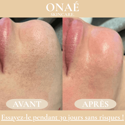 ONAÉ - Exfoliant Doux au Riz Blanc & Noir